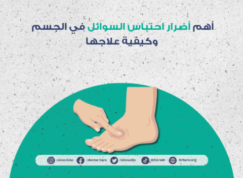 أضرار احتباس السوائل في الجسم