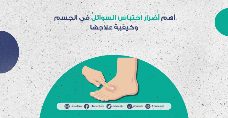 أضرار احتباس السوائل في الجسم