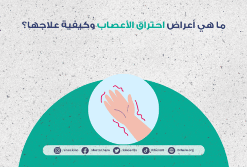 أعراض احتراق الأعصاب وكيفية علاجها