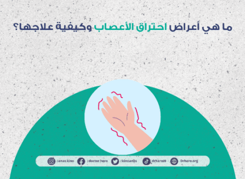 أعراض احتراق الأعصاب وكيفية علاجها